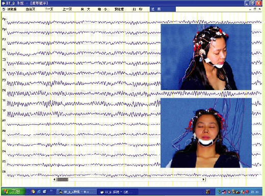 EEG—2.jpg