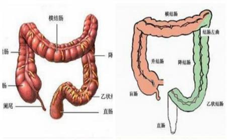 手术治疗:手术治疗是结肠癌的常用治疗方法,一般早期发现结肠癌较多