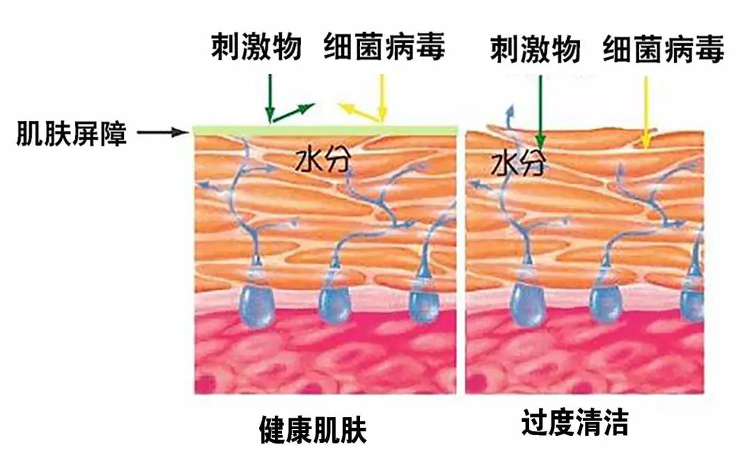 受损,在做护理的时候,我们就要尽可能地选择皮肤角质屏障的相关成分