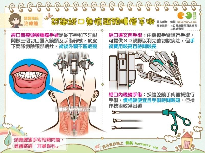 台湾长庚医院经口无痕头颈肿瘤手术 台湾长庚医院经口无痕头颈肿瘤手术