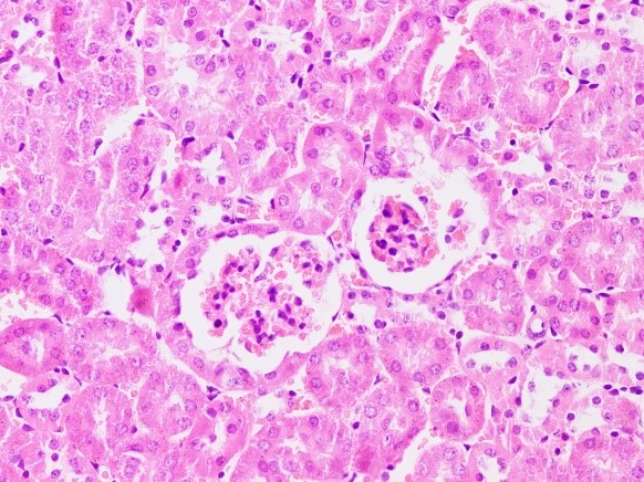 Cloud Zoom small image