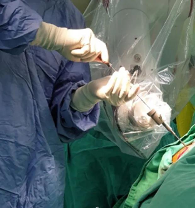 【臺灣長庚醫院】ROSA機器手臂讓手術更準確省時，醫病更放心