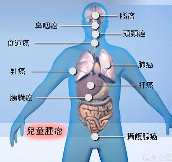 质子治疗 | 放射治疗怎么杀死肿瘤？