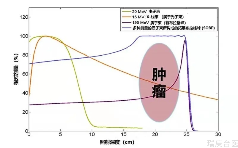 质子治疗 | 布拉格峰是什么呢？